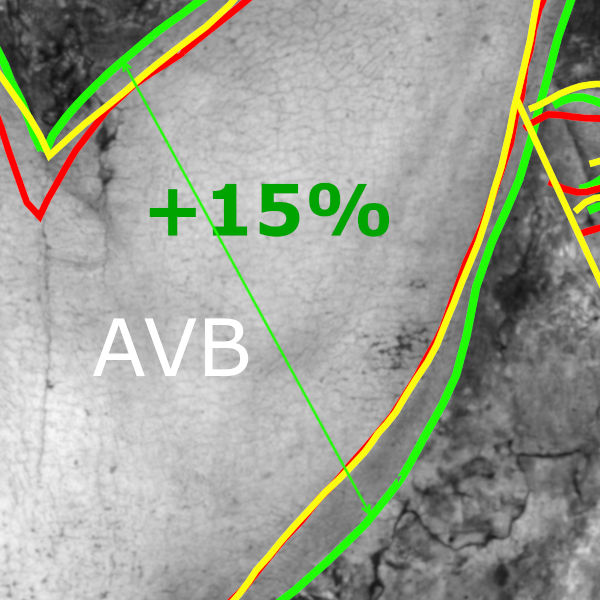 Comparative infrared detail of Christ’s forearm (AVB)