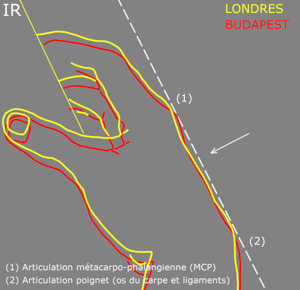 Infrared comparison showing the concave contours of Giampietrino’s London and Budapest versions.
